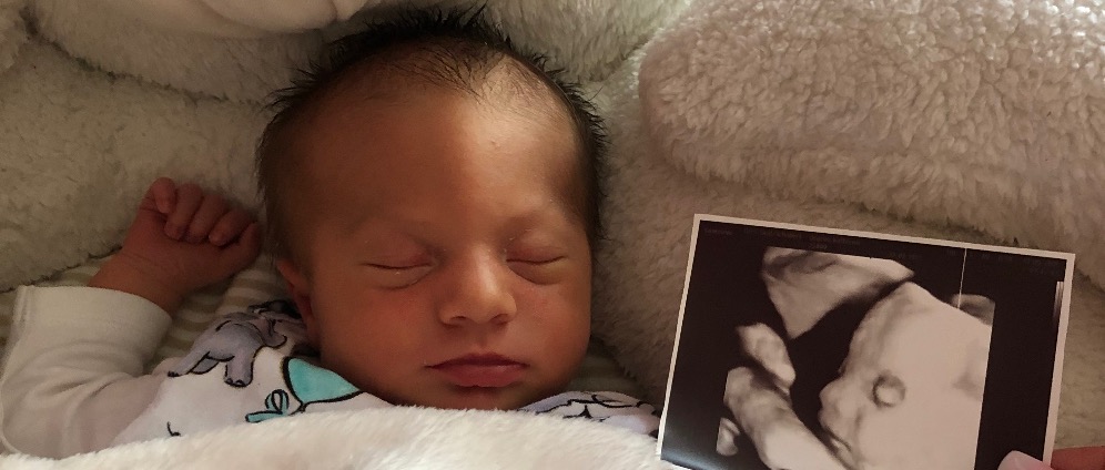 Spenden sammeln | Baby Felix Lio braucht Helmtherapie | Spendenseite
