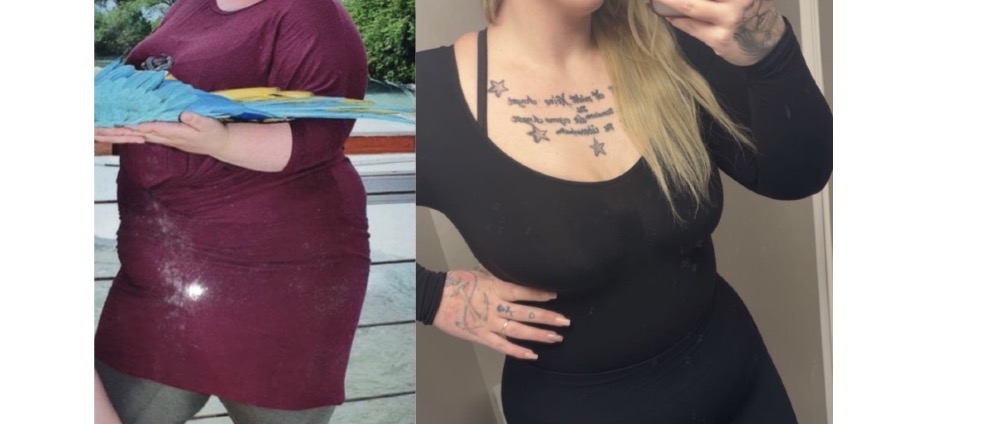 Spenden sammeln | Neues Körpergefühl nach Lipödem, Schwangerschaften und über 100 kg Abnahme | Spendenseite