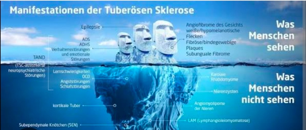 Spenden sammeln | Schnelle Hilfe bis ende des Monats | Spendenseite