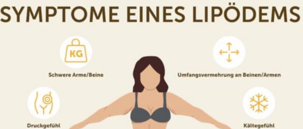 Spenden sammeln | Lipödem ist eine Krankheit | Spendenseite