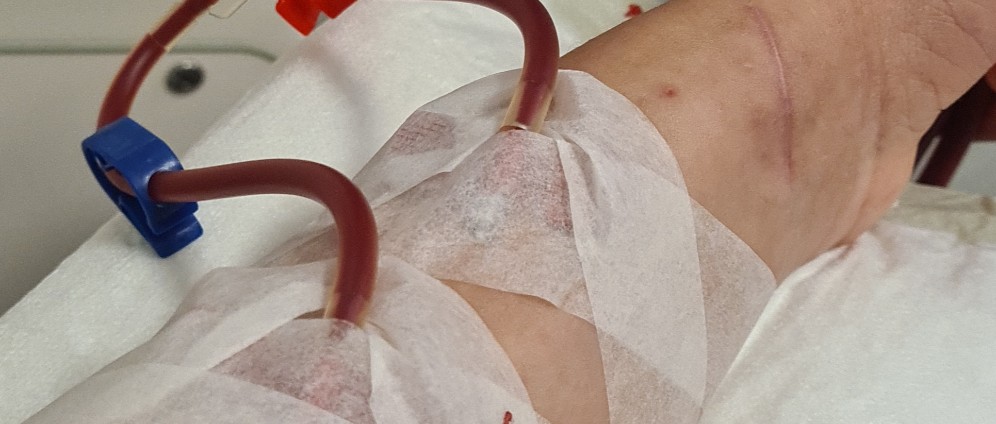 Spenden sammeln | Dialyse Zuhause ermöglichen | Spendenseite