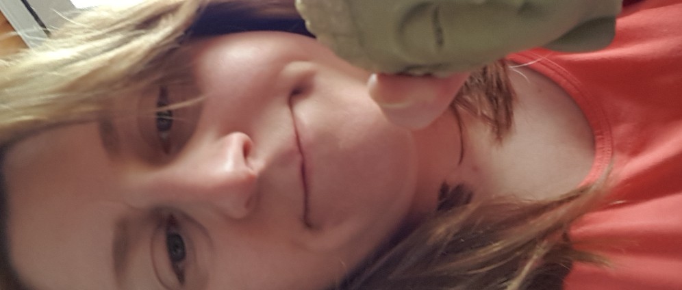 Spenden sammeln | Ausbildung als Medizinische Masseurin | Spendenseite