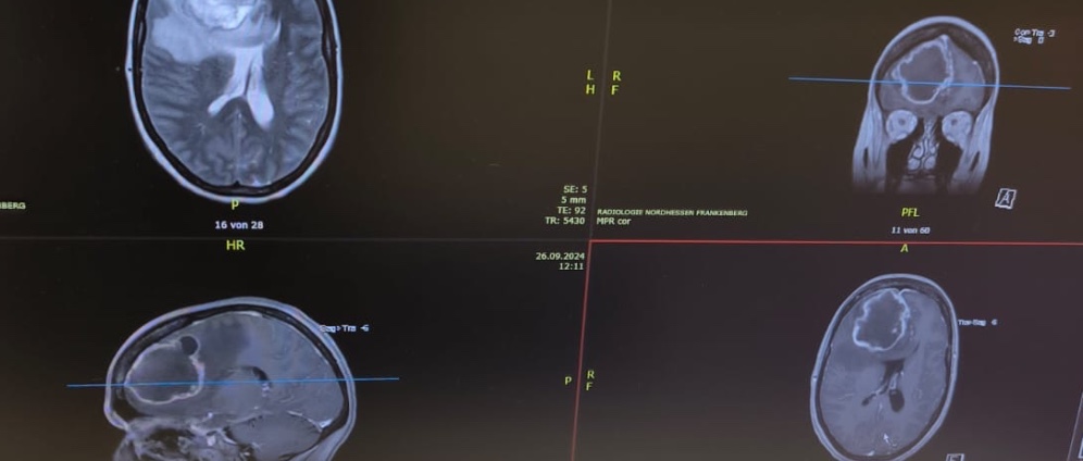 Spenden sammeln | Schenke Glücksmomente mit Hirntumor | Spendenseite