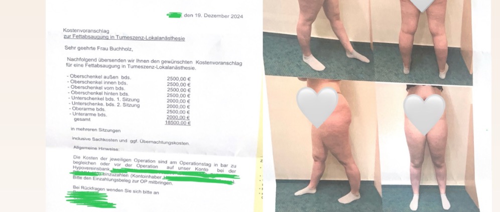 Spenden sammeln | Helft mir, den Schmerz hinter mir zu lassen! | Spendenseite