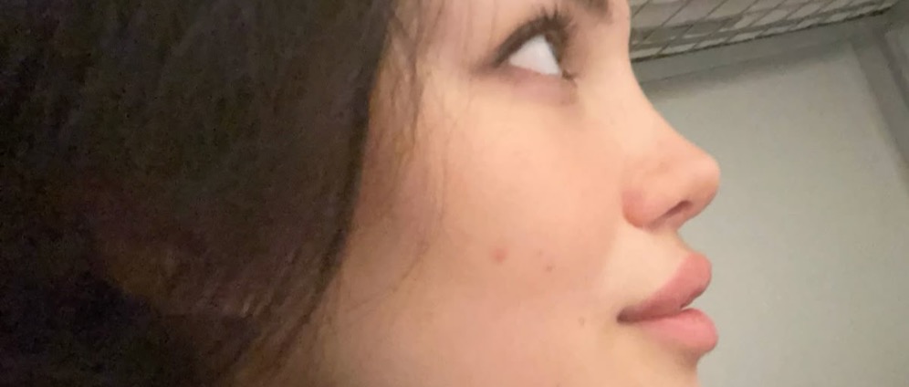 Spenden sammeln | Nose Job | Spendenseite