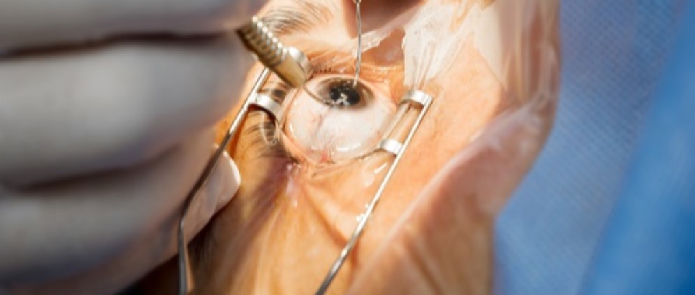 Spenden sammeln | Augen Operation | Spendenseite