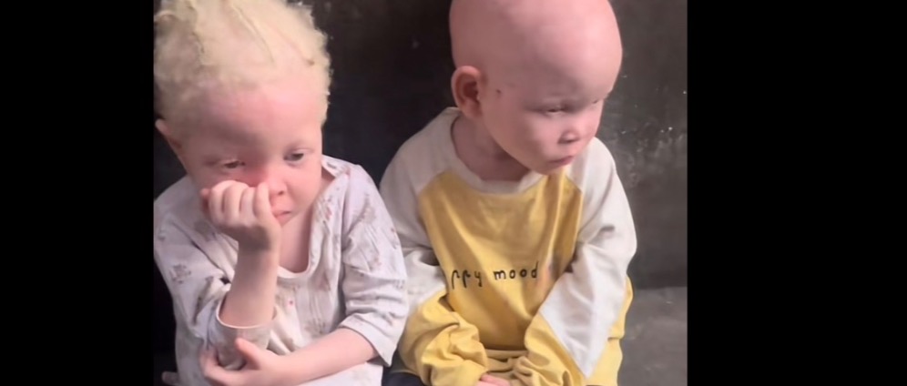 Spenden sammeln | Unterstützung für Albino Kinder in Afrika | Spendenseite