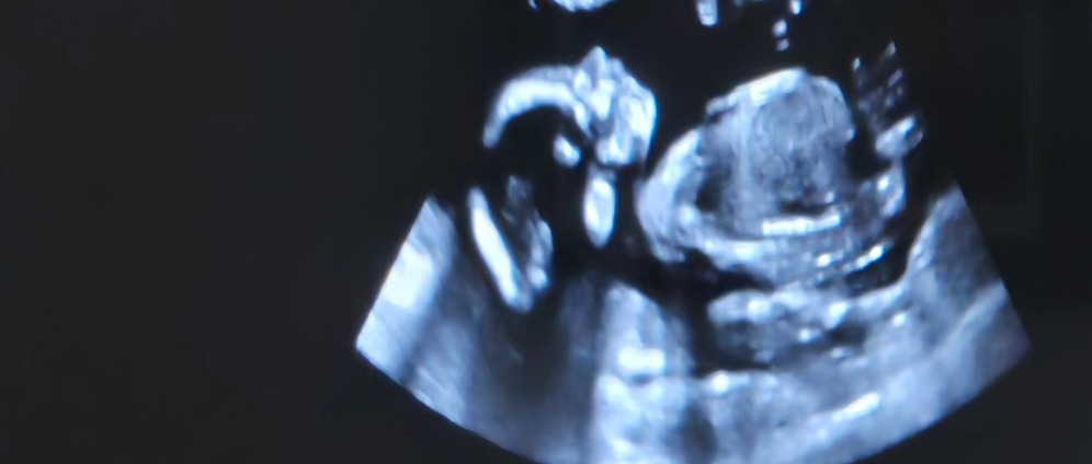 Spenden sammeln | Baby Erstaustattung | Spendenseite